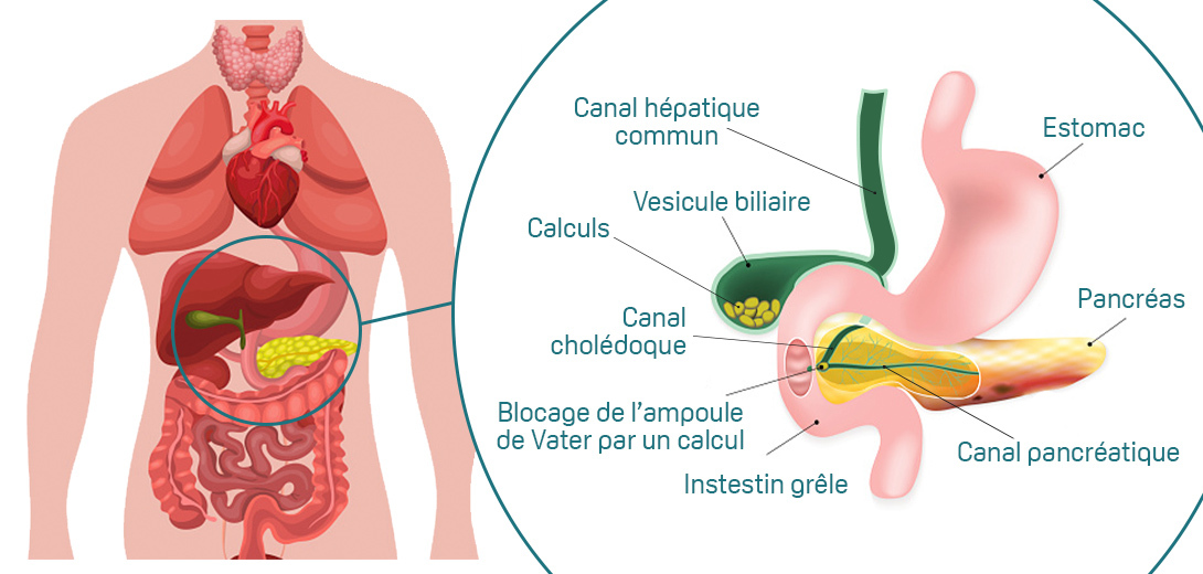 Vésicule biliaire à quoi ça sert